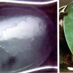 Två bilder av jade. Vänster visar en genomskinlig sten med molniga inslag, som illustrerar jade egenskaper. Höger visar en grön jade i en ring.